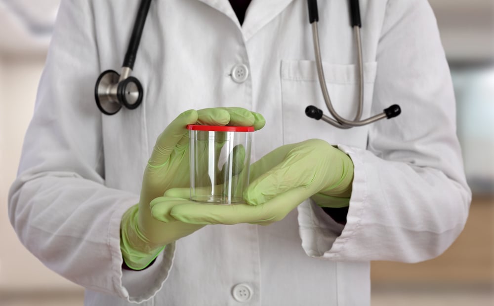 doctor holding empty specimen jar